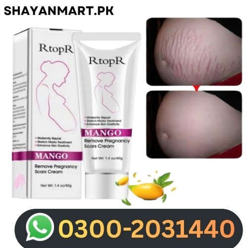 Mango Stretch Mark Cream In Pakistan