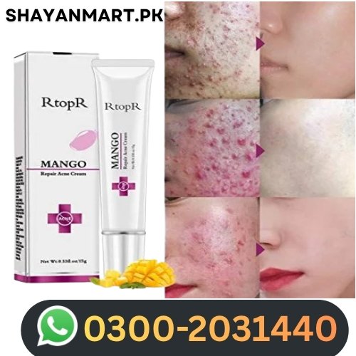 Mango Acne Cream In Pakistan